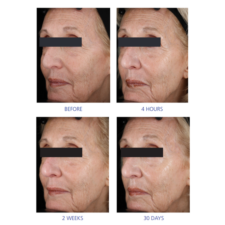 iS Clinical Youth Eye Complex 15g