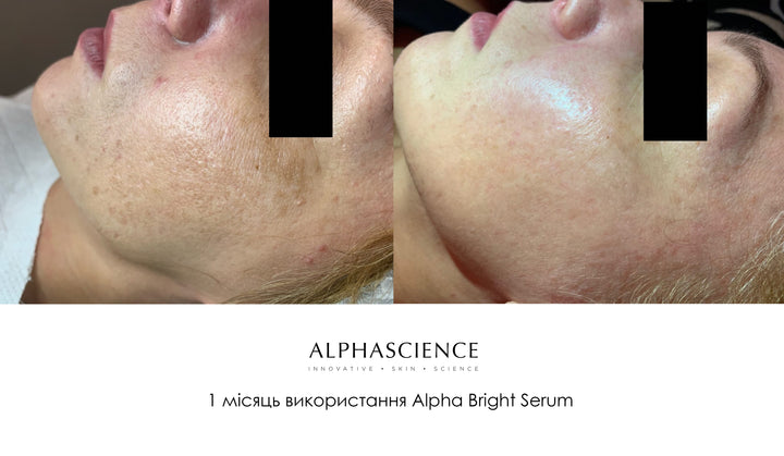 Alphascience Alpha Bright Pigment Correcting Serum - 20 ml