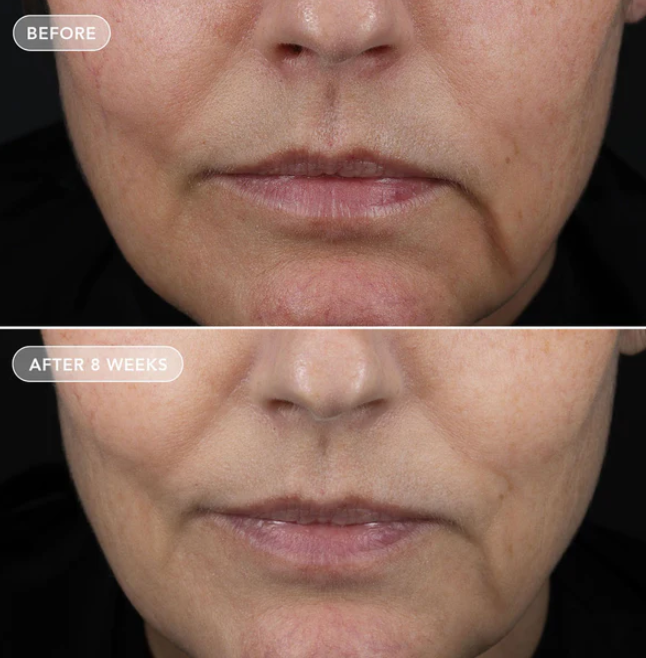 Image Skincare VOL.U.LIFT™ 57g