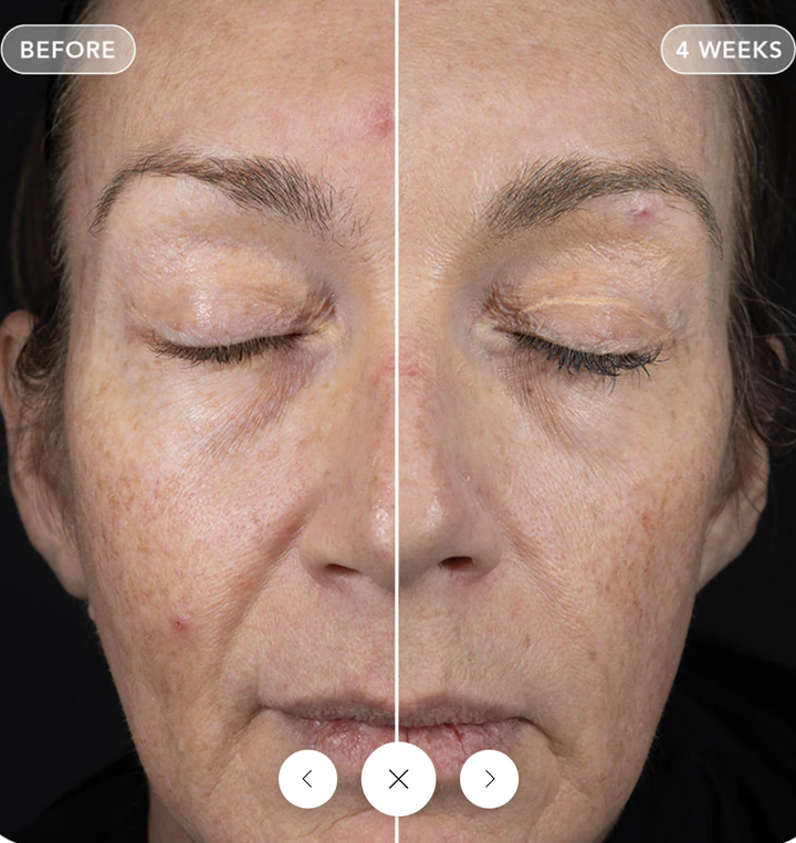 Image Skincare VOL.U.LIFT™ 57g