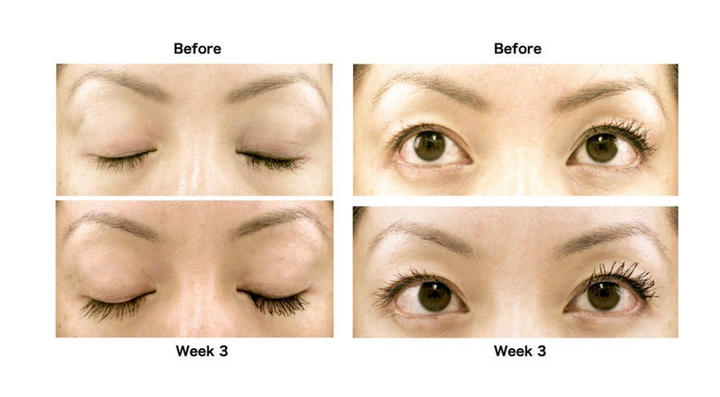 AQ Skin Solutions – Eyelash & Eyebrow Enhancement System